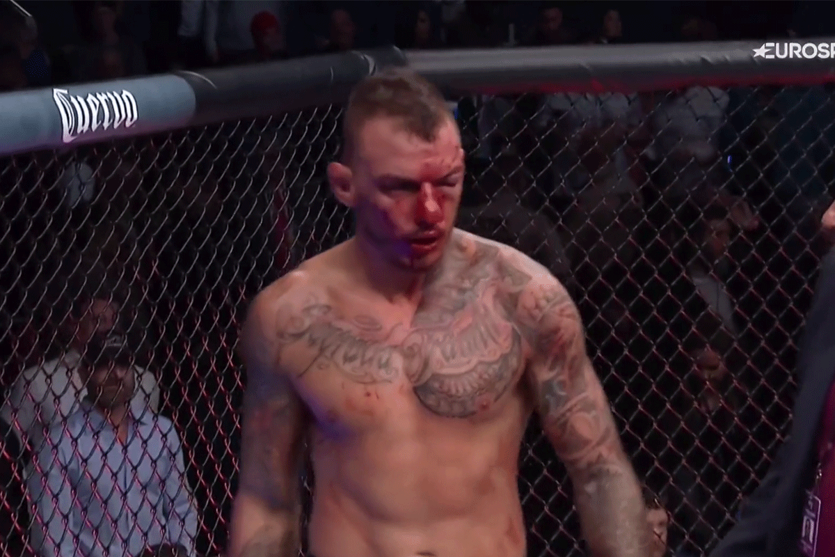 UFC'er Dos Anjos wilde dat bloedig gevecht stopte met Moicano