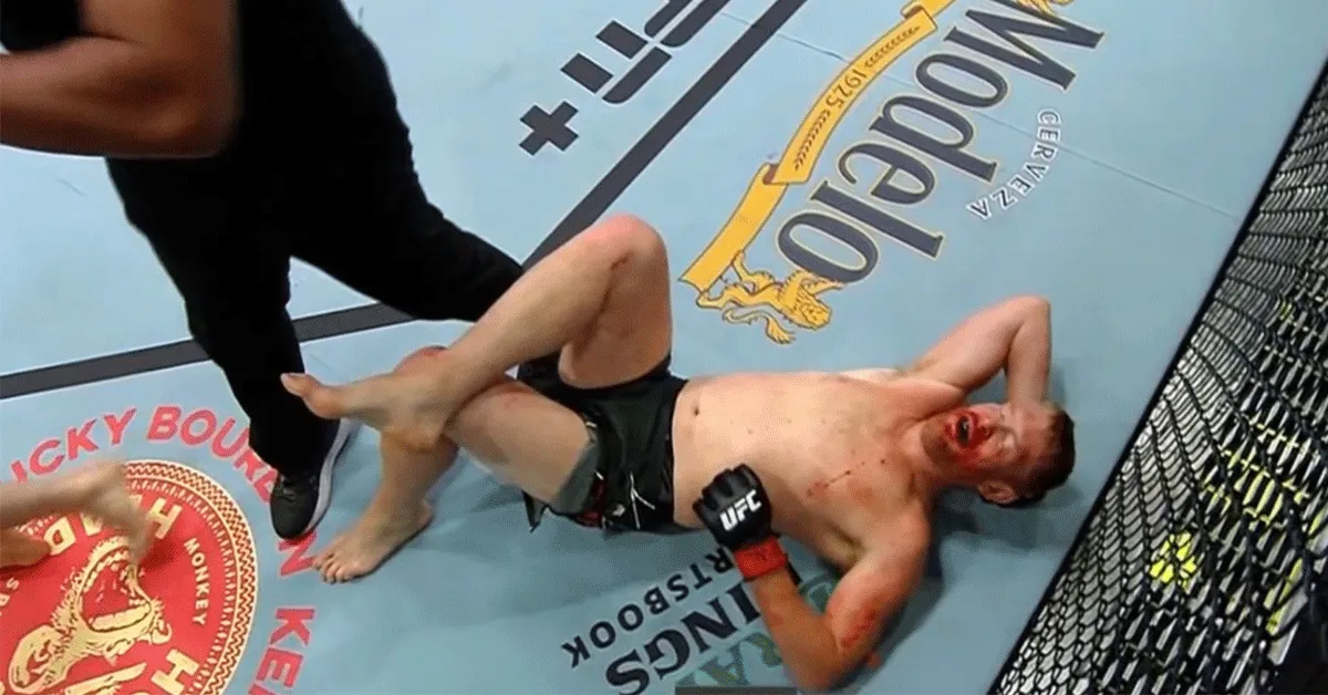 'Bloemkool door een rietje!' UFC-vechter Sam Alvey zwaar afgetuigd