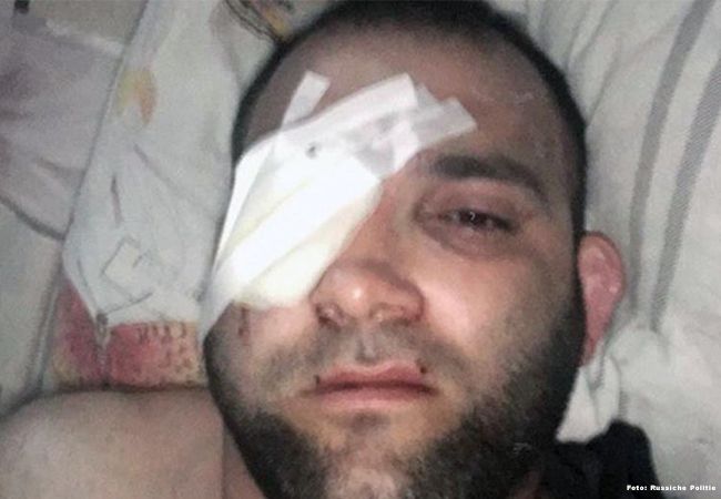 MMA-vechter 'verliest oog' bij arrestatie (video)