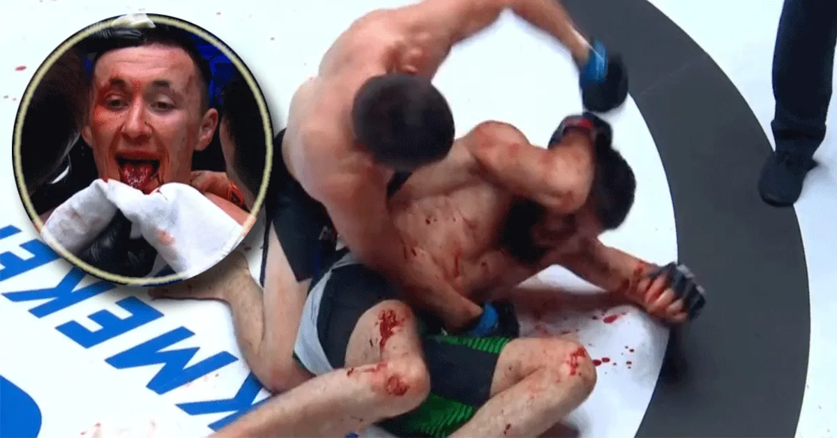 Dokter grijpt in! Bloederige tongblessure in chaos gevecht | video