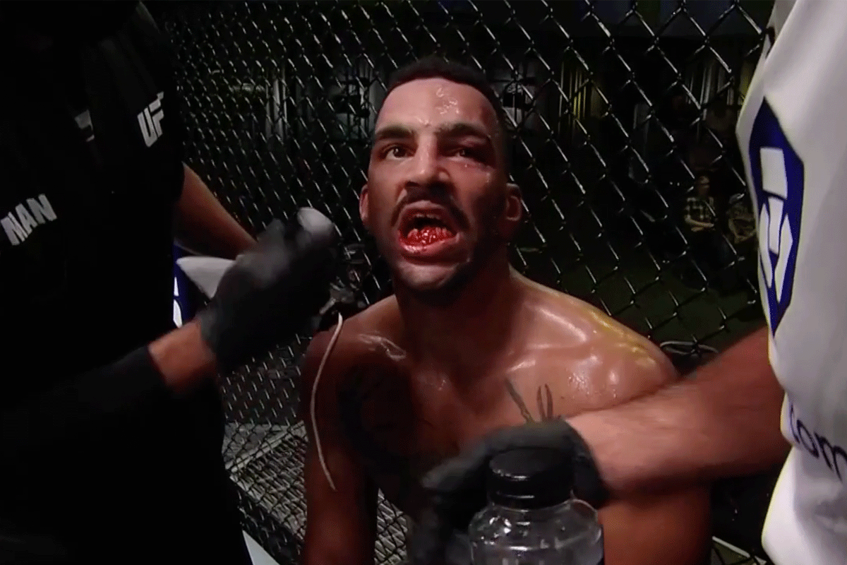 'Mijn tanden!' UFC'er MEPT gebit rivaal aan diggelen (video)