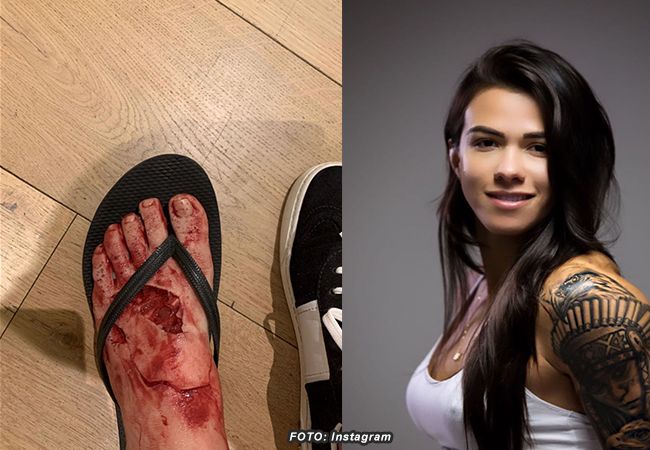 Gruwelijk: UFC-vechter Claudia Gadelha deelt bloederige foto