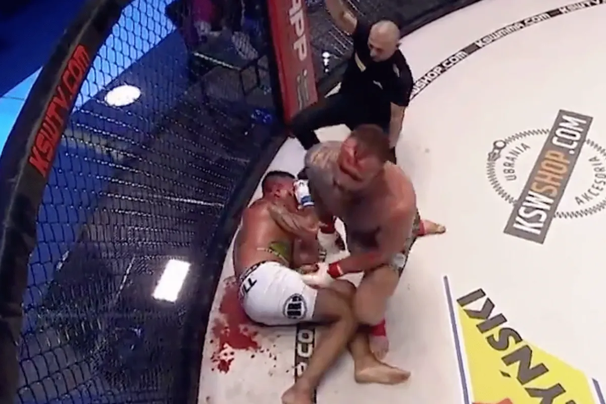 Ex-GLORY kickbokser tot bloederige pulp geslagen in gevecht (video)