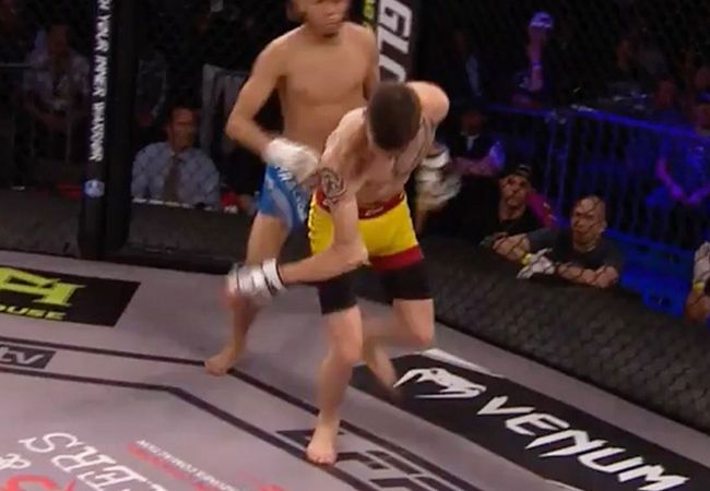 VIDEO | MMA vechter Jerome Rivera's bizarre arm blessure