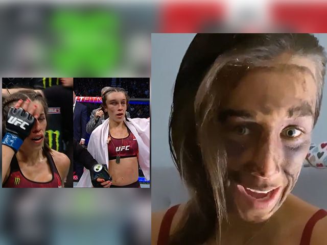 ? | ZWAAR TOEGETAKELD: 'UFC-vechter Joanna toont blessures'