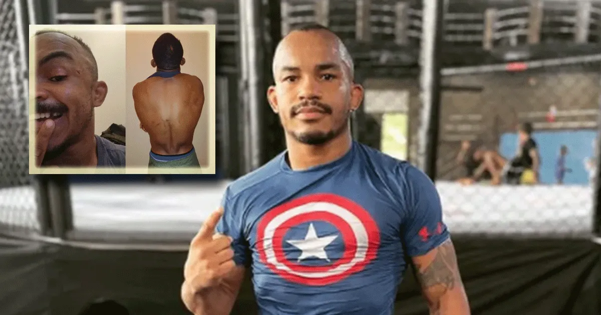 Bekende vechter (27) neergestoken en beroofd! 'Racisme'