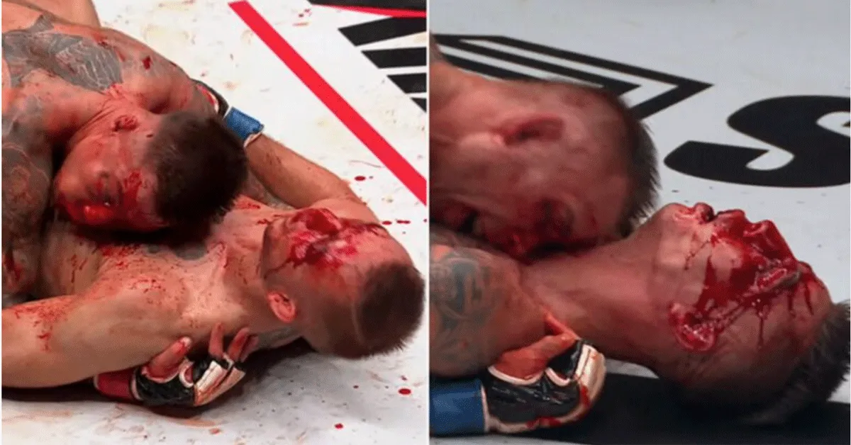 'Overal bloed!' Heftig gevecht opent MMA-event in Polen