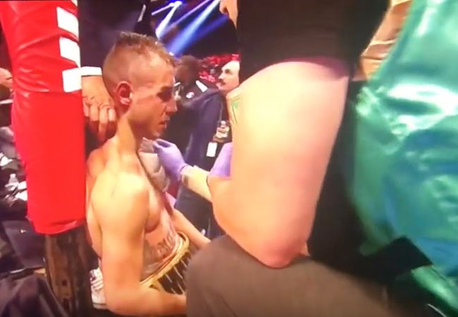 Maxim Dadashev sterft ten gevolge van hersenletsel