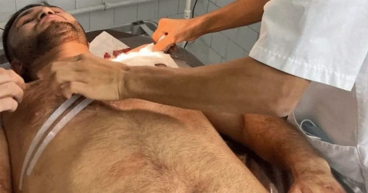 '10 keer gestoken!' Bokskampioen overleeft mes aanval