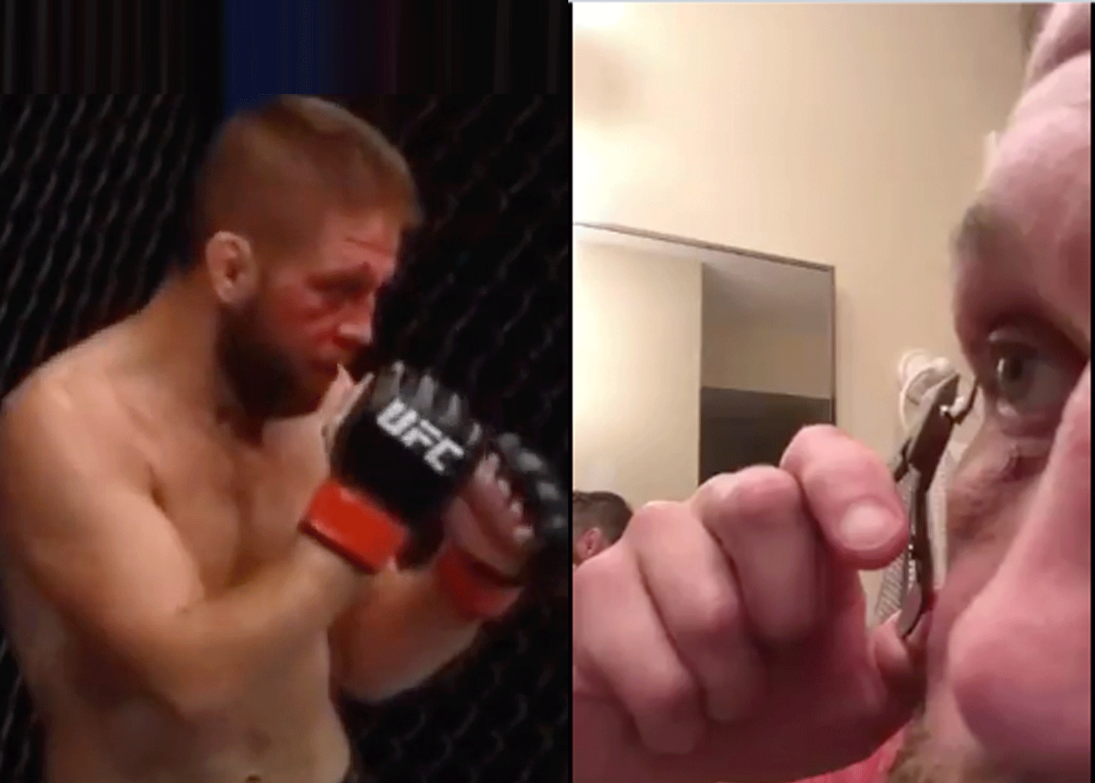 VIDEO: Halfblinde MMA-vechter haalt zelf hechtingen uit oog