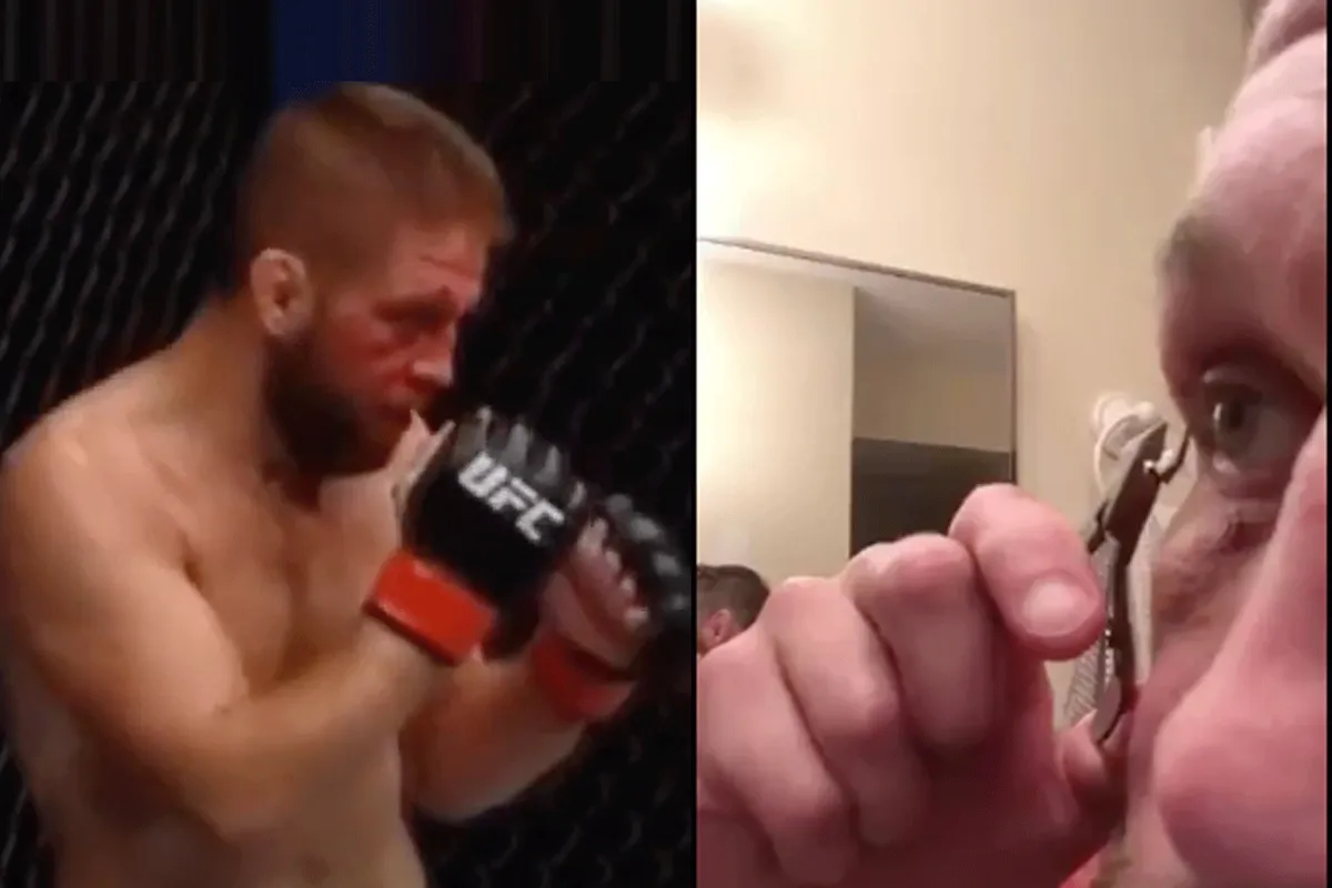 VIDEO: Halfblinde MMA-vechter haalt zelf hechtingen uit oog