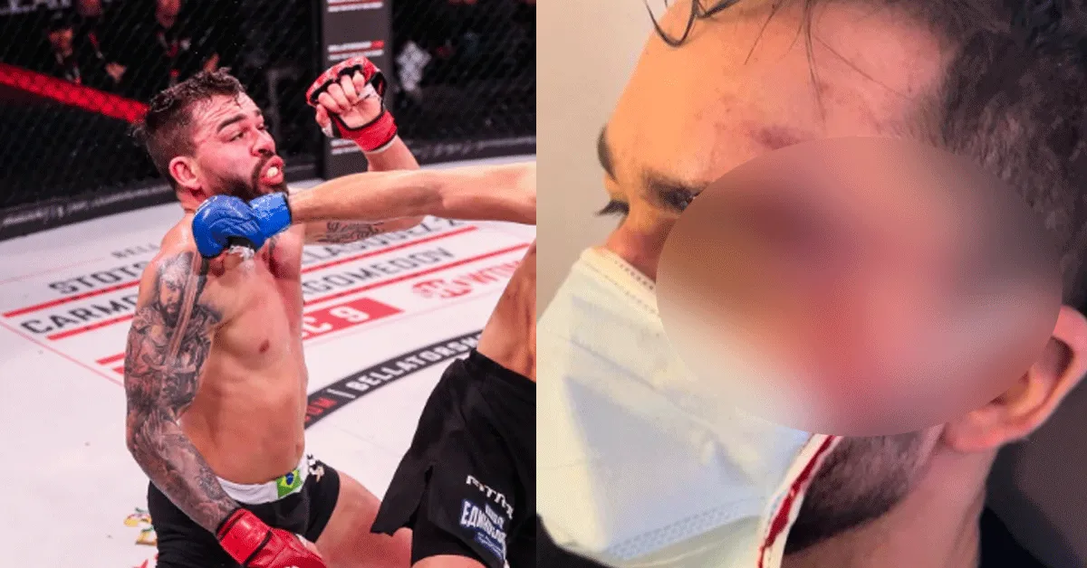 Knock-Out Video: Bellator vechter Freire 'sloopt' Japanner