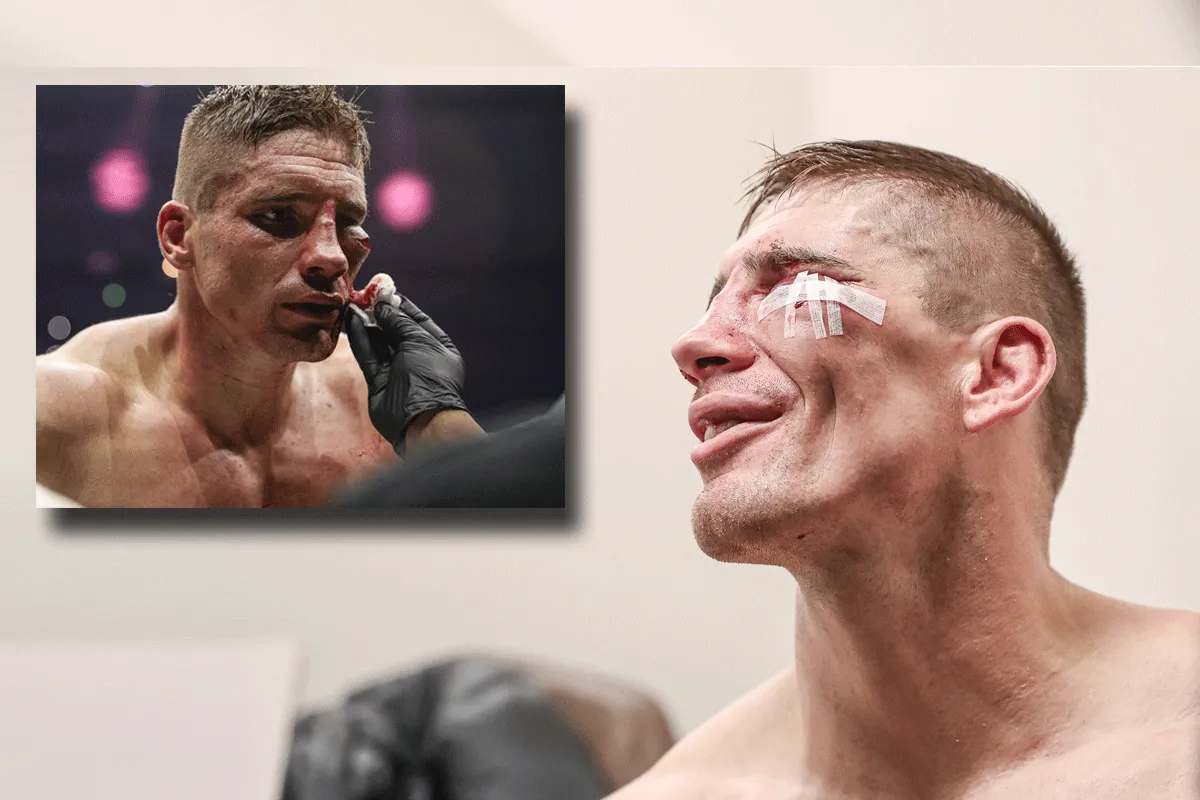 Rico Verhoeven in top 5 meest gruwelijke blessures
