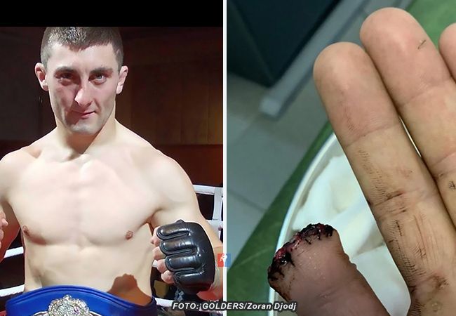 MMA-vechter verliest vinger: Gaat toch gevecht aan
