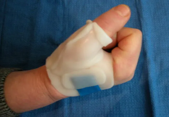 Aandoeningen zoals artritis en artrose veel voorkomend bij vechtsporters