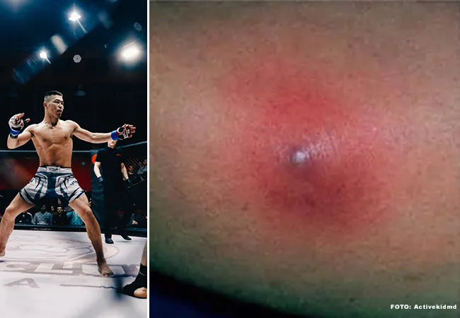 Levensgevaarlijke bacterie rukt op in de sportschool