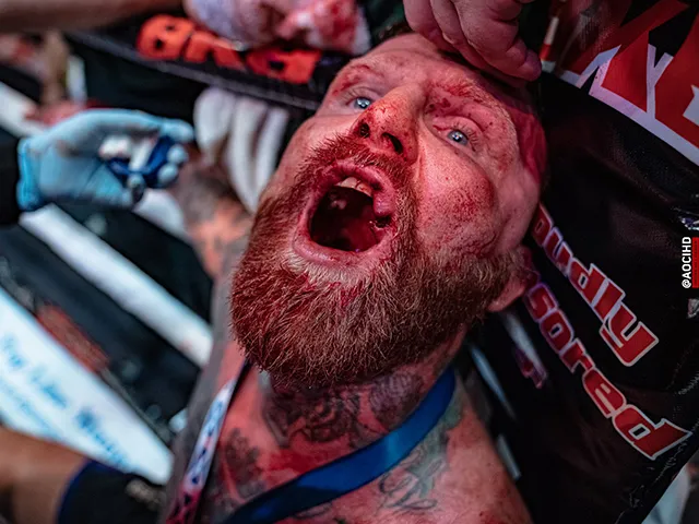 Bare Knuckle boksen veroorzaakt minder hersenschade dan normaal boksen en MMA