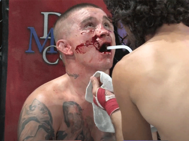 BLOEDSPORT VIDEO: 'Dit is Bare Knuckle MMA vechten'