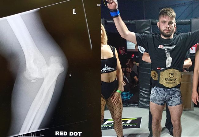 MMA-vechter 'breekt arm' maar pakt toch wereldtitel