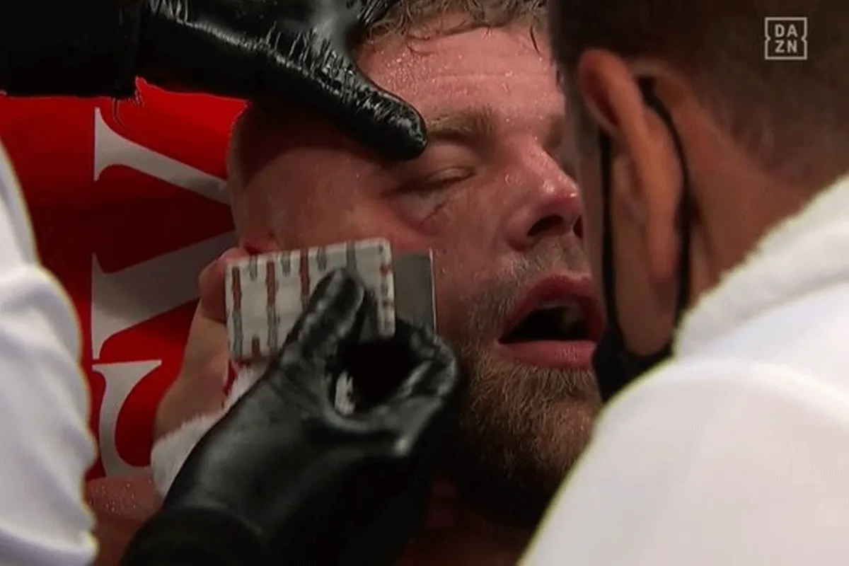Kapot geslagen: Waarom Saunders niet verder kon tegen Canelo