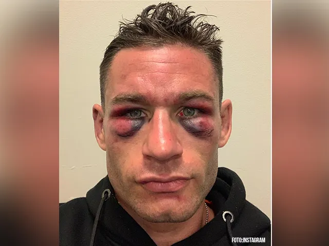 ? |HEFTIG: Vechters delen foto's van zware blessures