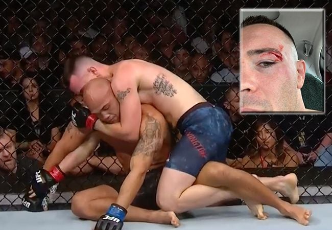 UFC-vechter Colby Covington zweeg over gevaarlijke blessure