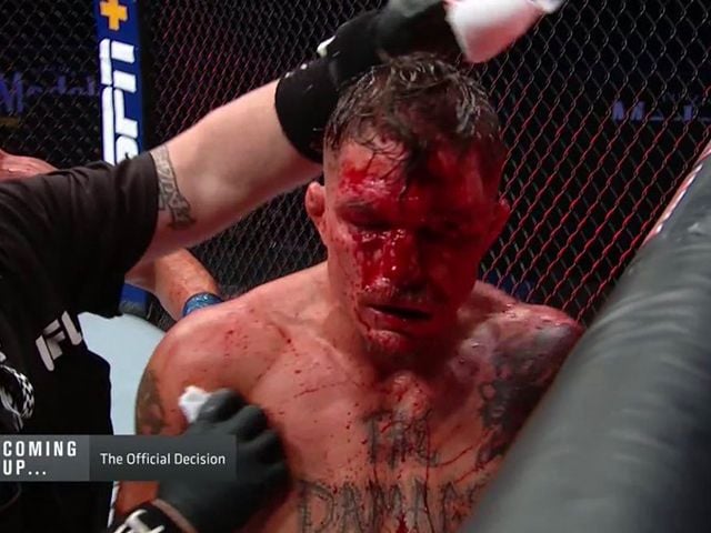? | BLOEDINFUUS: UFC-Vechter loopt leeg tijdens gevecht (video)
