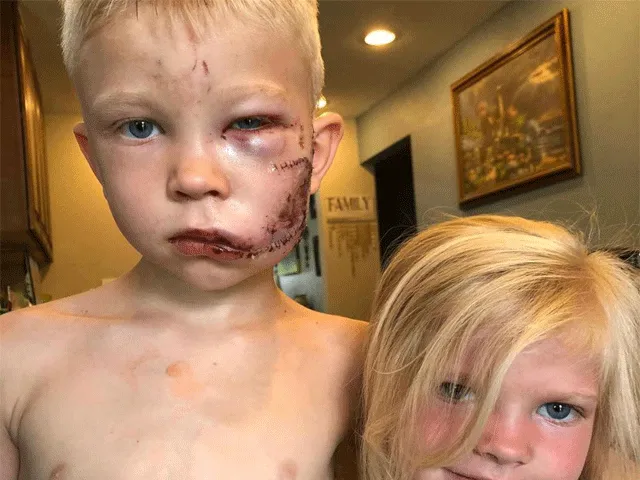 HELD: 6-jarige krijgt wereldtitel boksen voor redden zusje