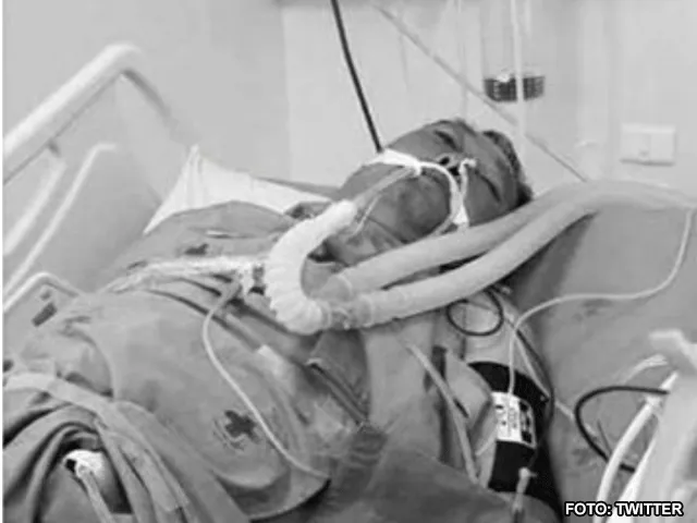 BIZAR: Kickbokslegende overlijdt na fatale insectenbeet