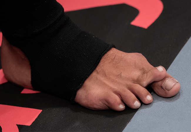 MMA Vechter knokt door ondanks freaky blessure