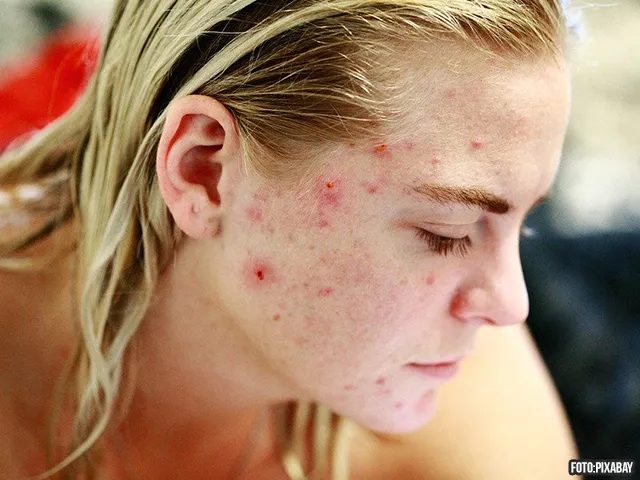 LET OP: Sportscholen broedplaats voor bacteriën en ziektes