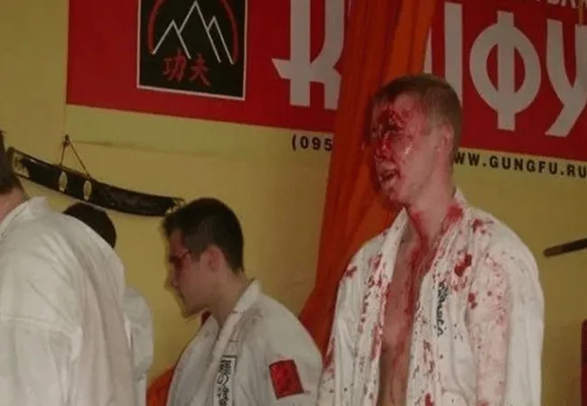 Risico's van herhaald impact op het hoofd bij vechtsporten!