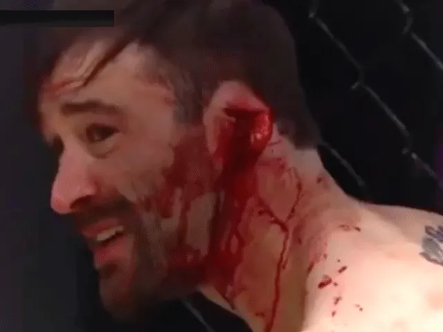 MMA-vechter verliest oor tijdens bloederig gevecht (video)