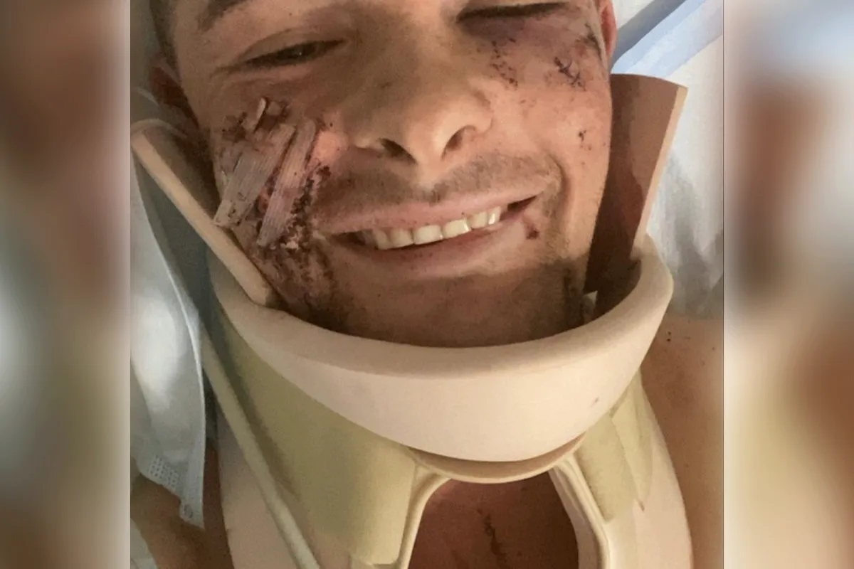 Neergeschoten en gestoken MMA-vechter vocht letterlijk voor zijn leven