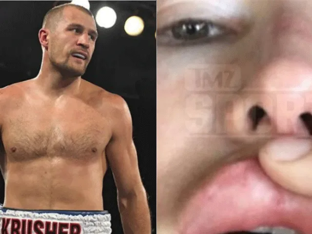 Topbokser bekend schuld voor mishandelen vrouw en hond (video)