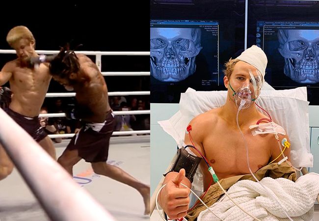 MMA-vechter Sage Northcutt: Zware operatie na brute knockout