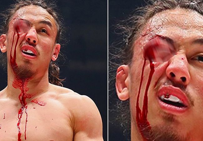 Ontplofte oogbal bij MMA-vechter na brute actie (video)