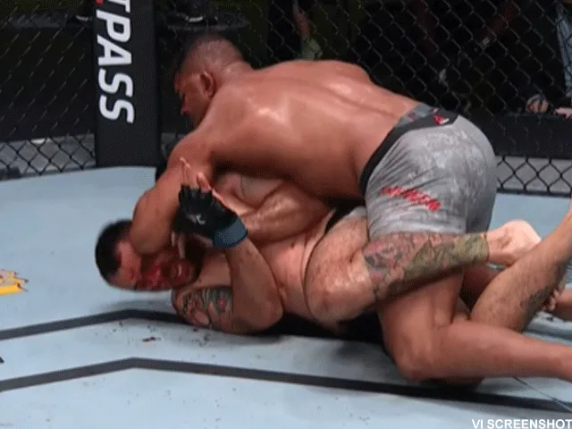 GEBROKEN BOTTEN: Alistair Overeem sloopte tegenstander Sakai