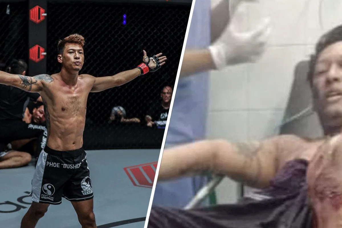 Schokkende foto MMA-vechter vrijgegeven, 'slachtoffer bomaanslag'