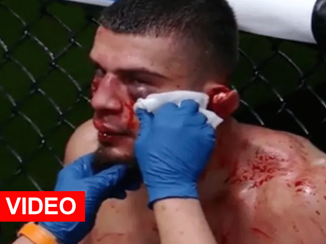 VIDEO: Oor MMA-vechter flappert losgeslagen langs hoofd