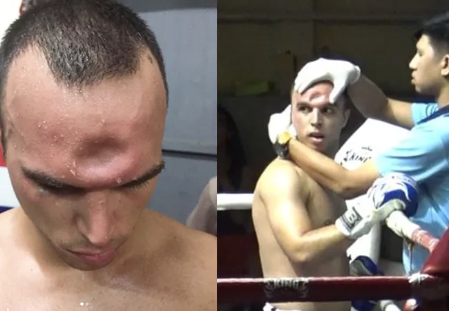 Video opgedoken van bizarre schedelbreuk tijdens Muay Thai gevecht!