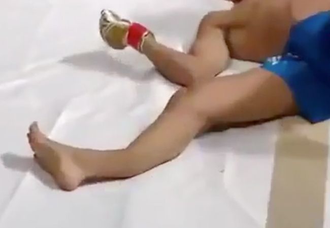VIDEO: MMA vechter trapt scheenbeen in twee tijdens gevecht