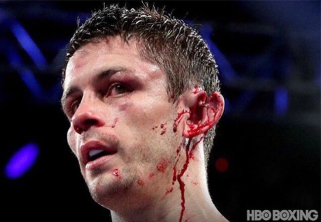 VIDEO: Bokser Stephen Smith zijn oor er bijna afgerukt tijdens bokspartij