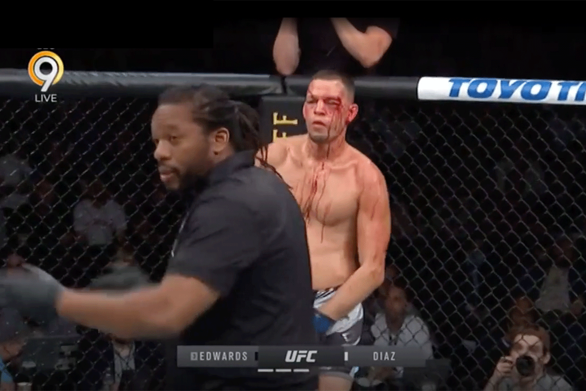 UFC Bad Boy Nate Diaz stuurt rivalen tergende boodschap