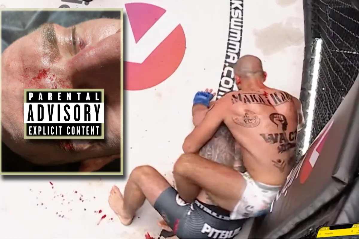 🎥 Gruwelijke wond bij MMA-vechter schokt fans na waanzinnig gevecht