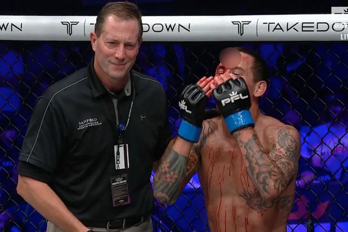 ENG! Gruwelijke blessure beëindigt MMA-gevecht op PFL 6 (video)