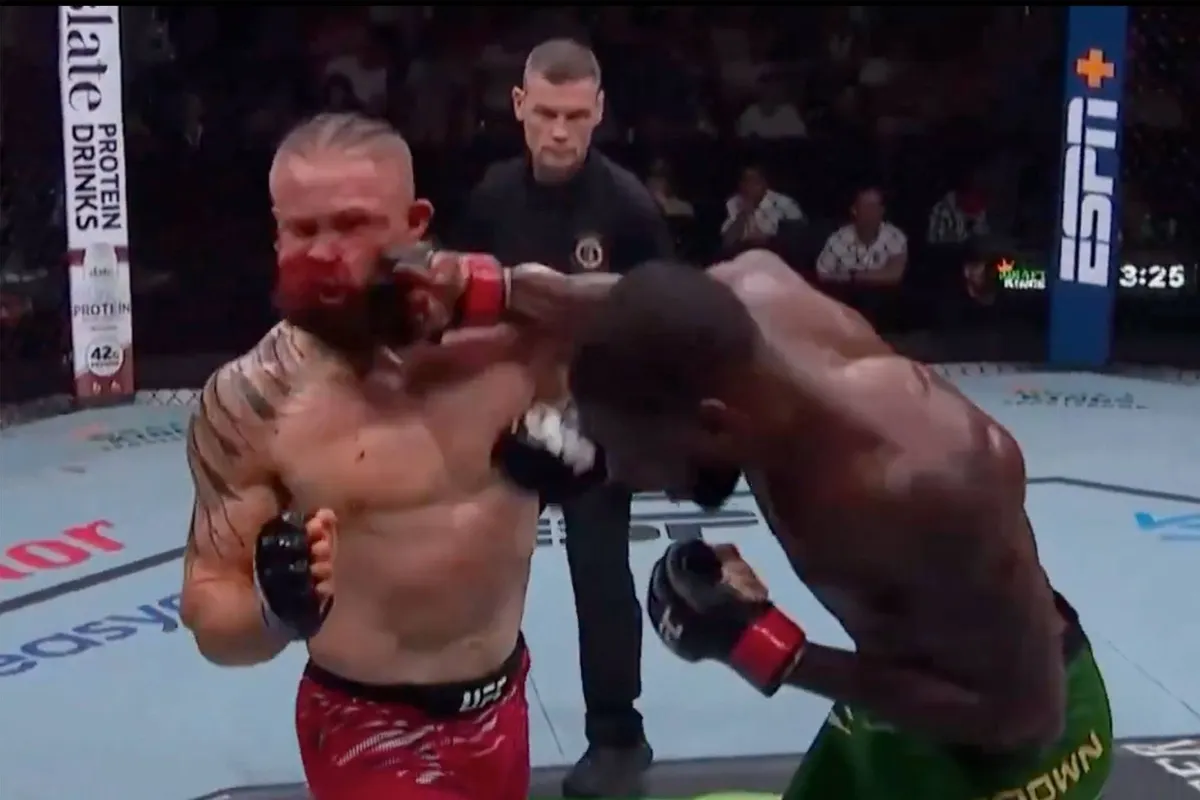 Harde klap! UFC vechters gezicht compleet verpletterd na keiharde mokerslag - video!