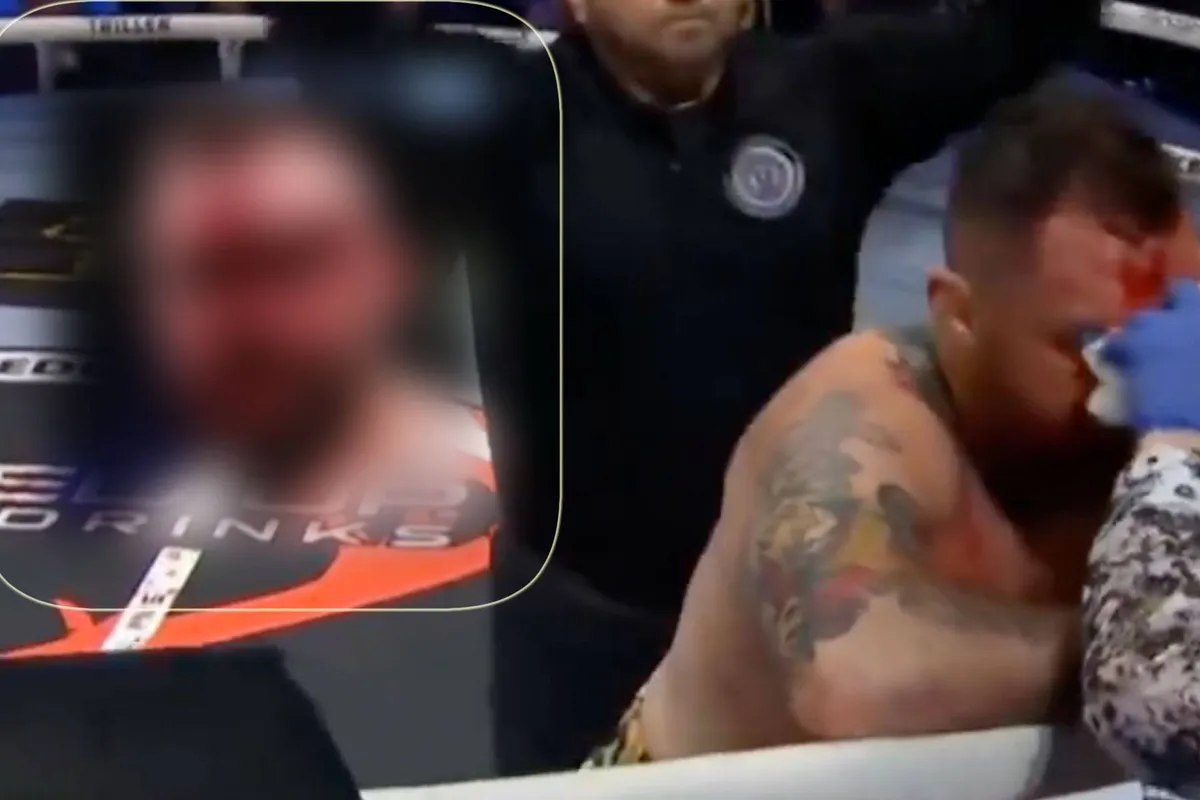 Bokskampioen verliest gezicht en titel - dit is wat bare knuckle met je doet