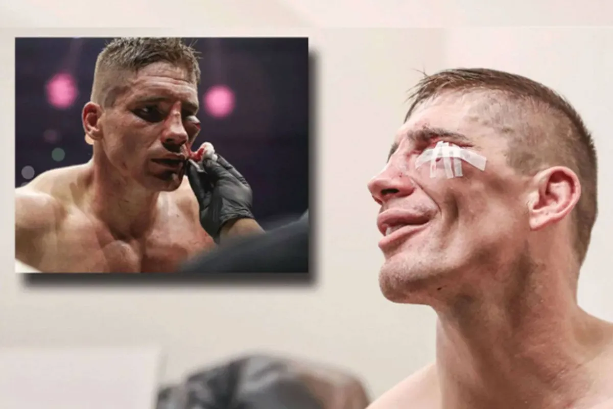 Deze Rico Verhoeven gadget werkt altijd… zelfs als z’n gezicht kapot is