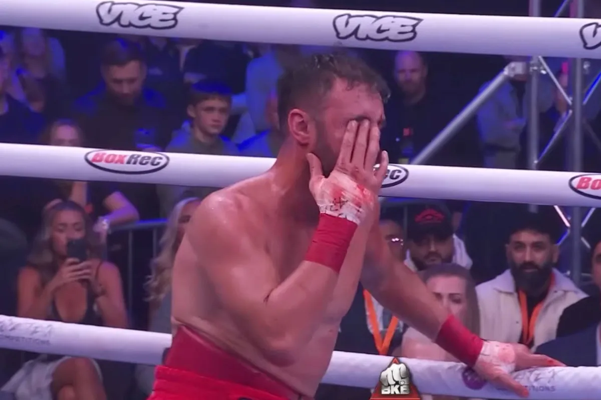 Bokskampioen blind aan één oog na bruut bareknuckle gevecht - toekomst onzeker